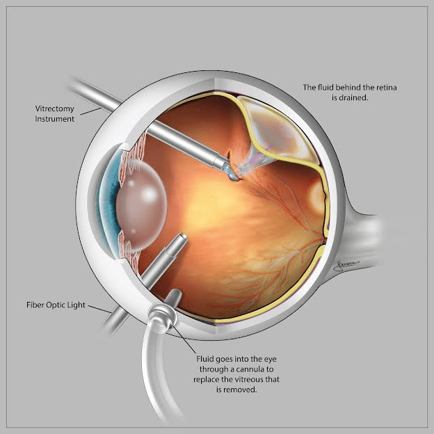 Retina Care - Image 1
